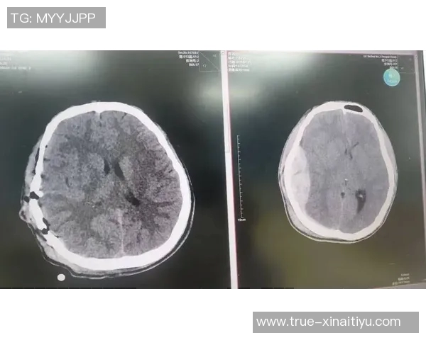 科贝：奥维耶多后卫比达尔头部被撞，初步诊断颅脑严重损伤